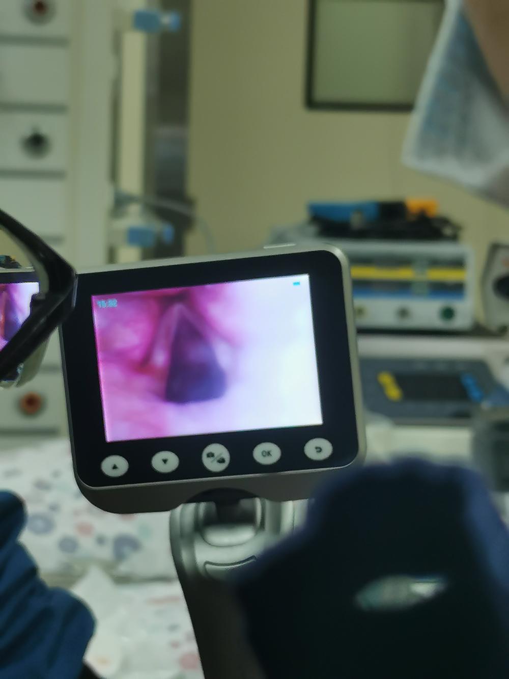 困难气道插管视频,困难插管