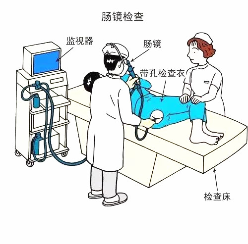 做肠镜之前清肠的亲身经历,清肠几个小时以后做肠镜最合适