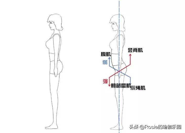 假胯宽怎么消除最有效,假胯宽是什么原因怎么治