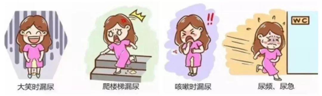 【大写的尴尬】大笑咳嗽时尿*禁失**了——四维超声带你认识盆底健康