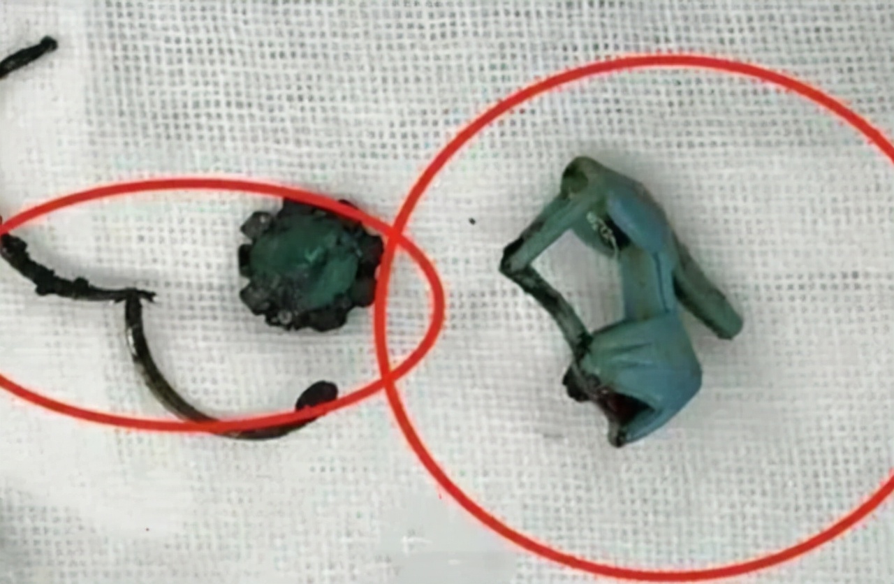 6岁的女孩有异味怎么回事,六岁女孩有异味是怎么回事