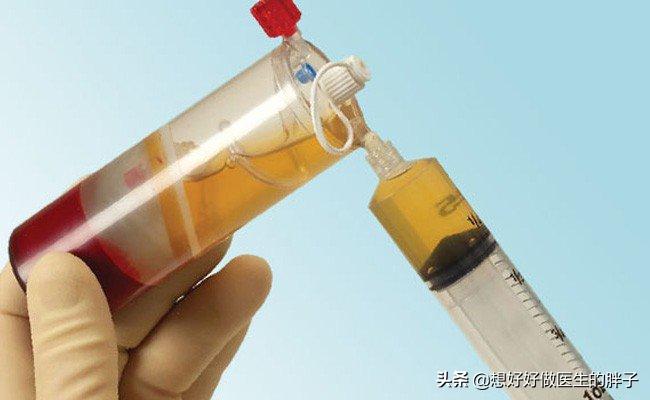 医院治髌骨软化症怎么样,专家教你快速治疗膝关节