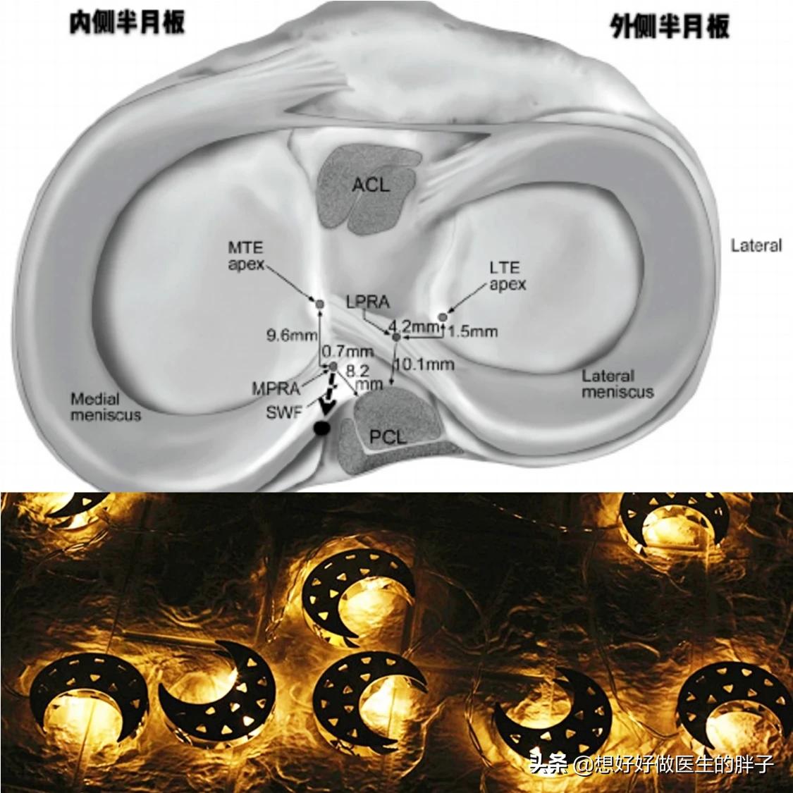为什么足球运动员不会半月板受伤,足球运动半月板损伤