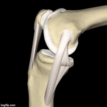 髌骨软骨损伤膝盖总是咔咔响,膝盖损伤后髌骨响是什么原因