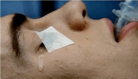 什么叫手术中知晓,医生诊断要做手术该了解什么