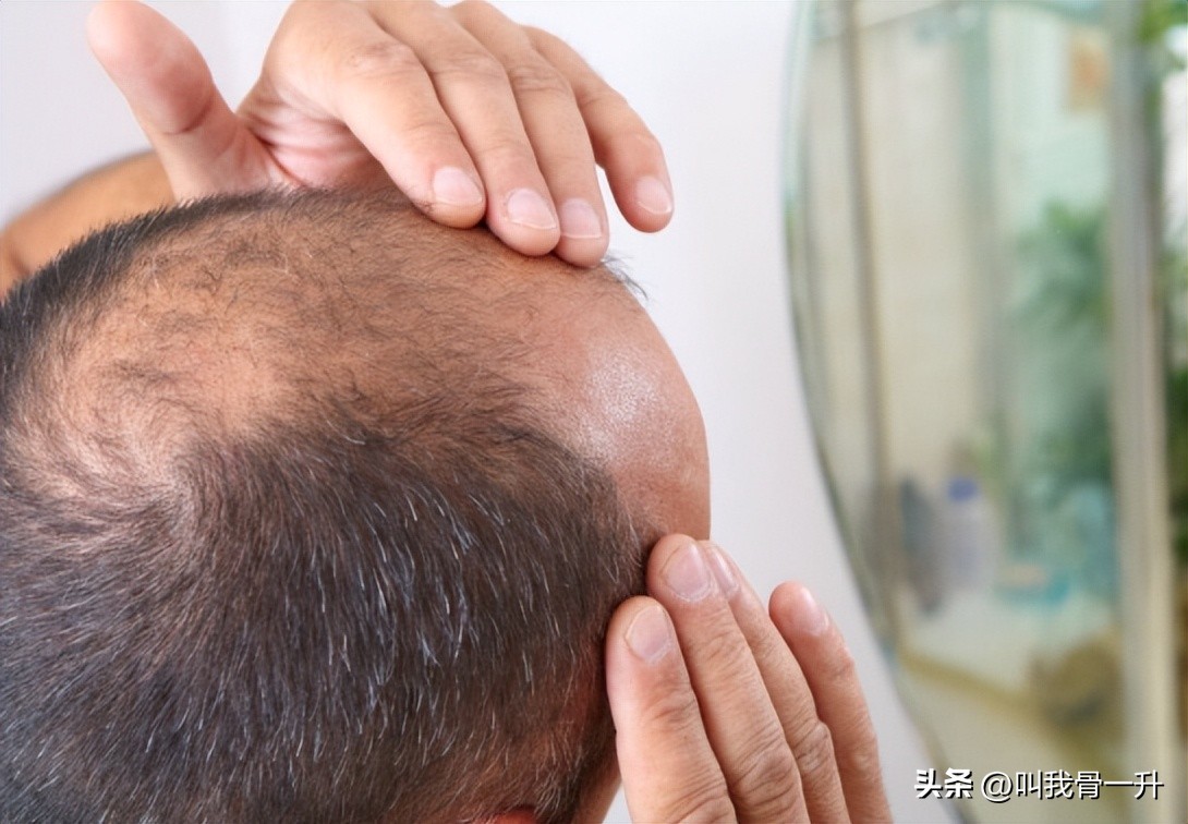 12岁小孩头发稀少怎么变浓密,怎么让头发变浓密食疗