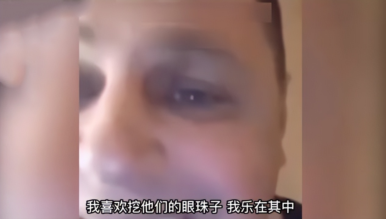 乌军医生承认“活摘战俘器官”，不打麻药，连麦时一脸骄傲