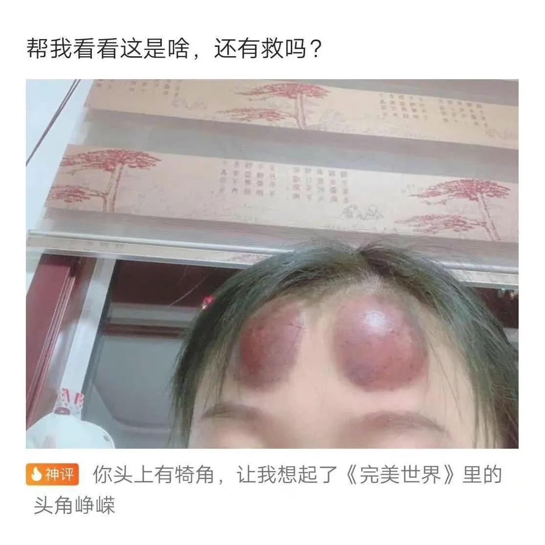 爬山回来手指头长毛什么梗,爬山回来手指头长了几根毛什么梗