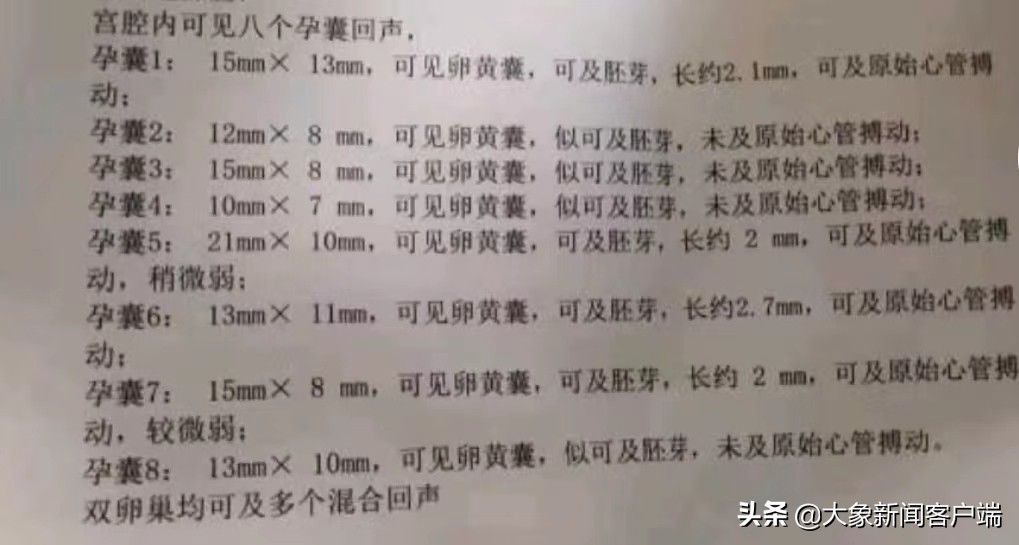 郑州女子怀上八胞胎原因,改变主意生二胎