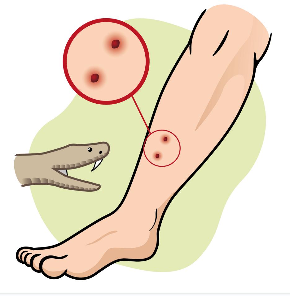 为什么杀完毒蛇后一定要把蛇头埋掉？厨师没有遵守，酿成悲剧