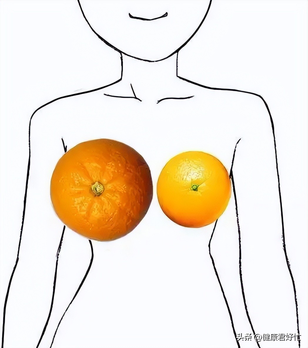 有哪些乳腺知识一定要了解,女生乳腺冷知识