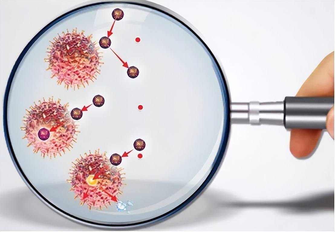 尿路感染最常见的致病菌有哪些,发生尿路感染最常见的感染途径是