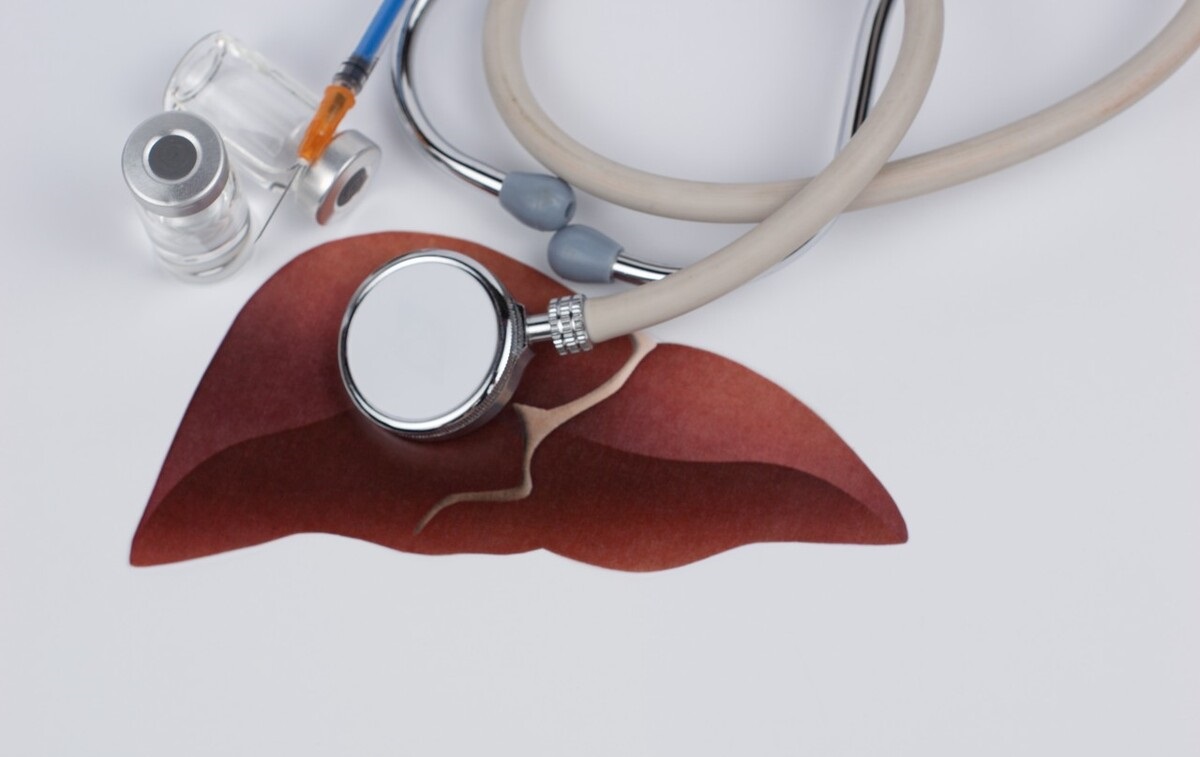 老年人直接胆红素偏高要注意什么,三项胆红素都偏高平时应注意什么