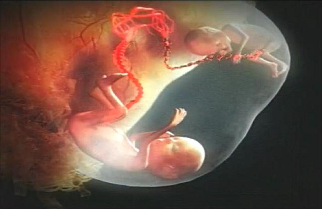 印度小伙意外怀孕,印度男子腹中神秘生物