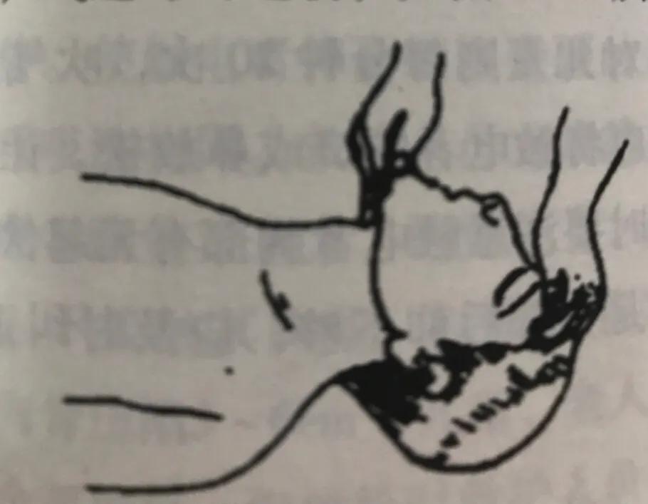 发现有人触电怎么办,经常静电触电怎么办