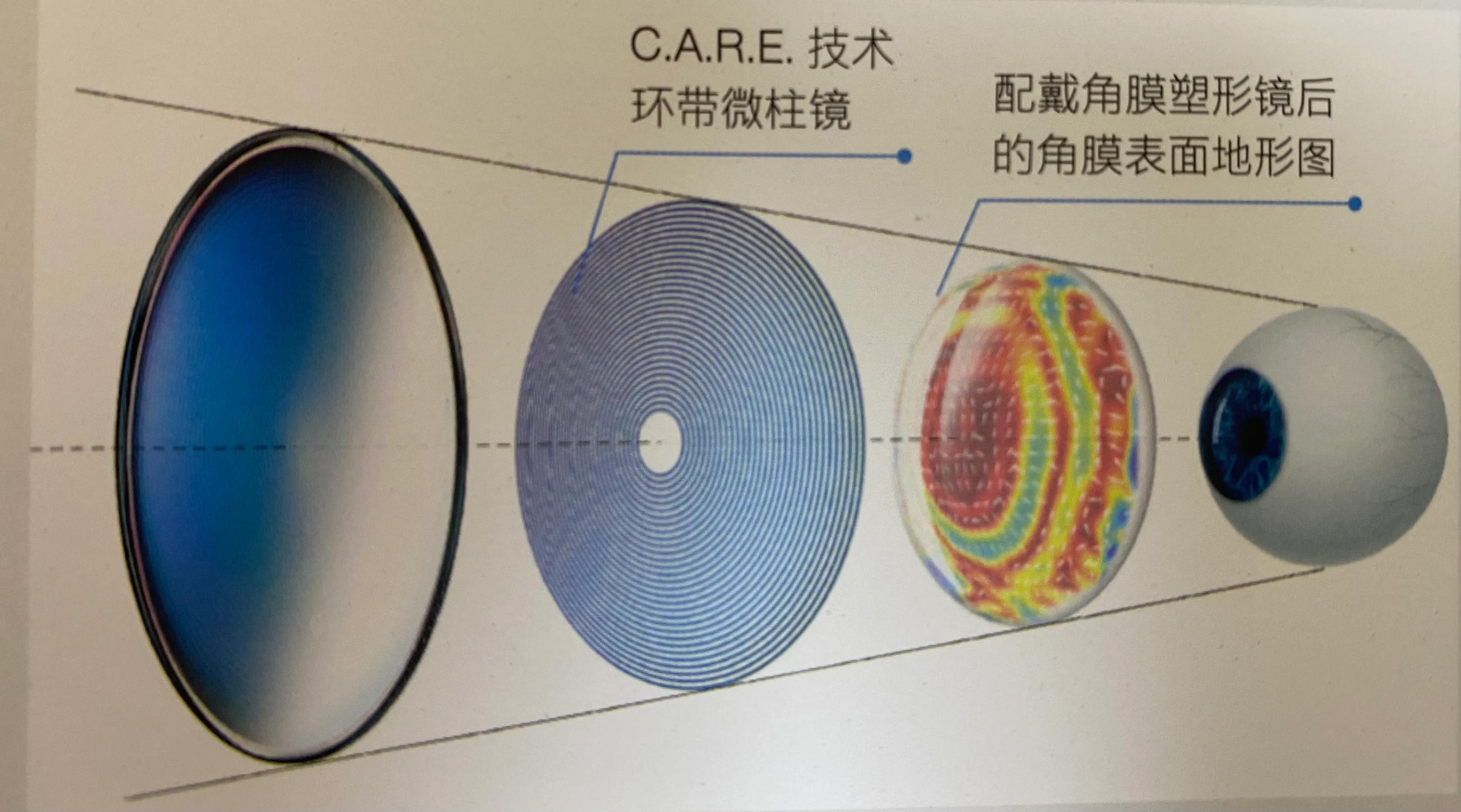 蔡司新乐学与星趣控的区别,蔡司小乐圆和新乐学星趣控区别