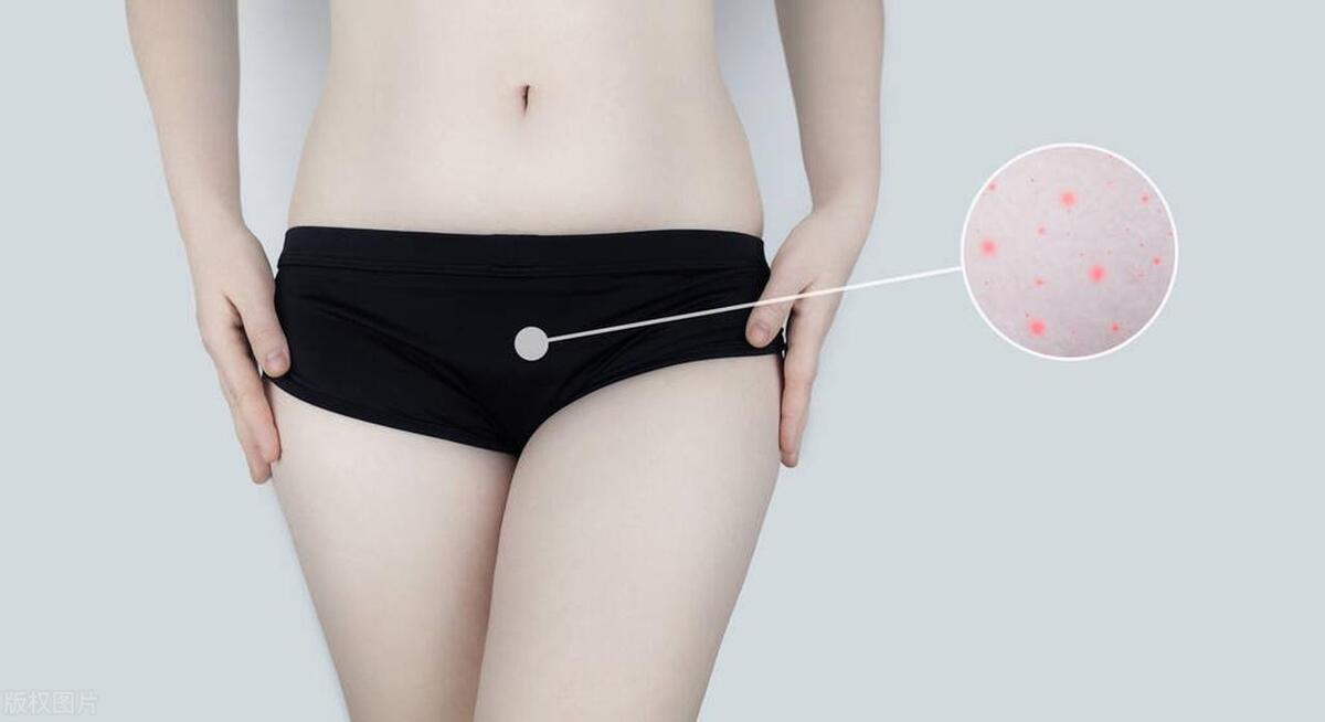 常见阴道炎种类及用药,阴道炎的分类及治疗用药