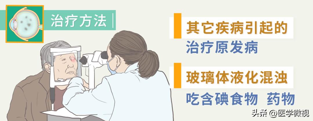 总感觉眼前有虫子在飞什么原因,老是觉得眼前有小飞虫在飞