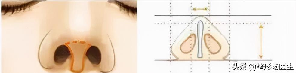 人中太长了好看吗,人中太长显老怎么办