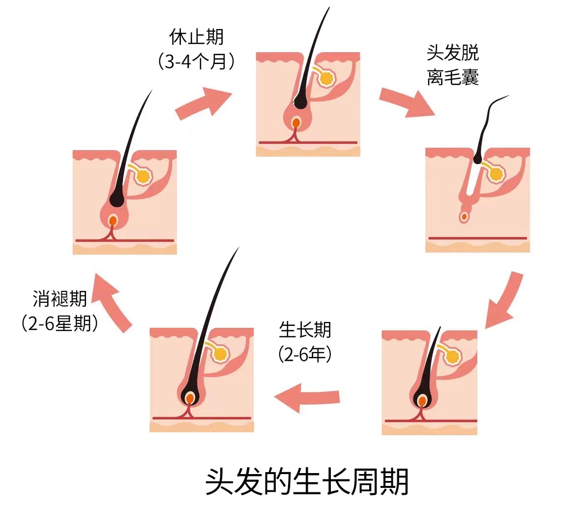 脱发脱得严重用什么防脱发,防脱要趁早改善脱发