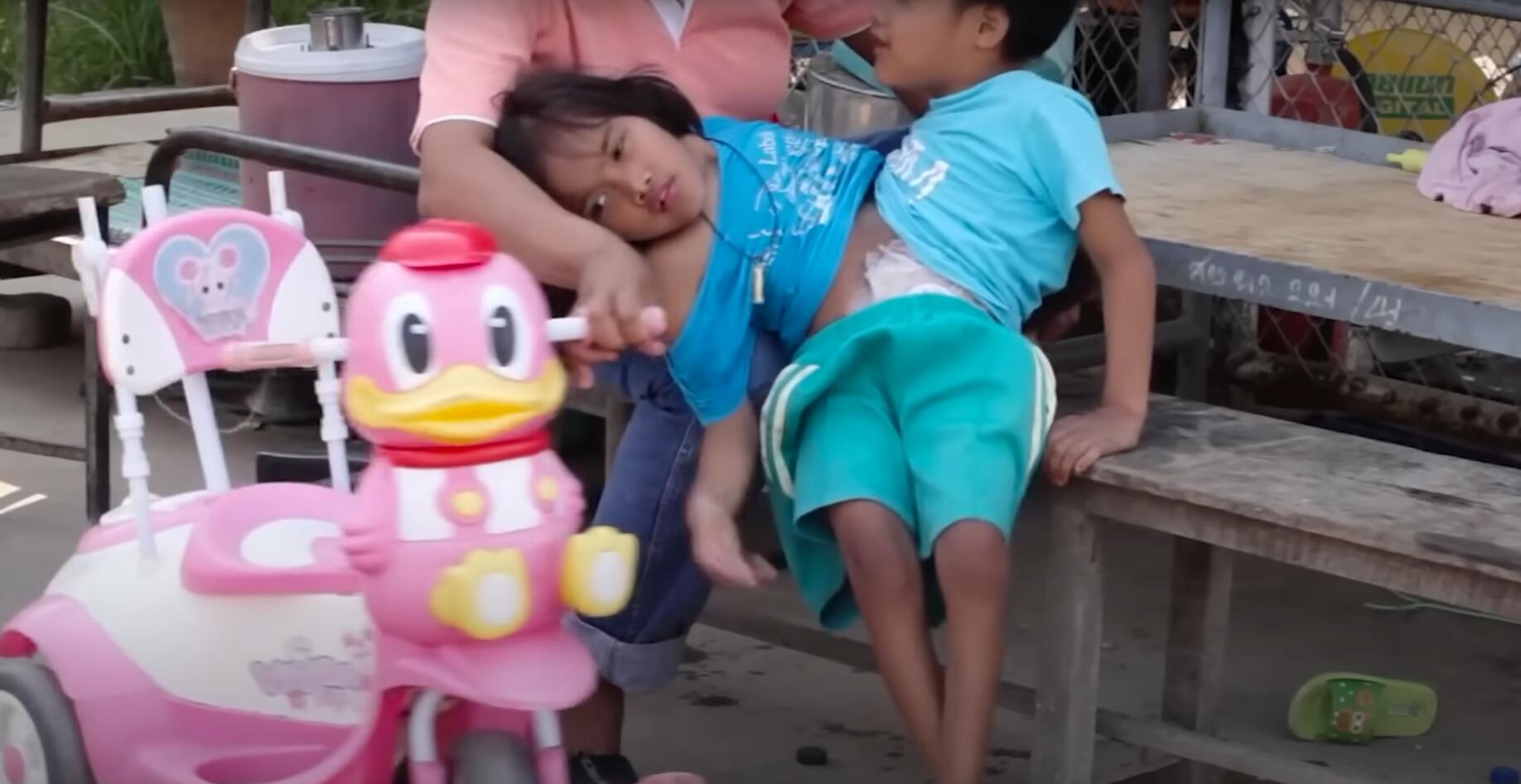 10个难以置信的人类，树皮人、外星人、拥有粗壮手臂的大力水手