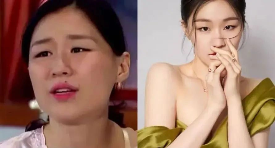 科颜氏美白淡斑精华去痘印,科颜氏美白淡斑精华液去痘印