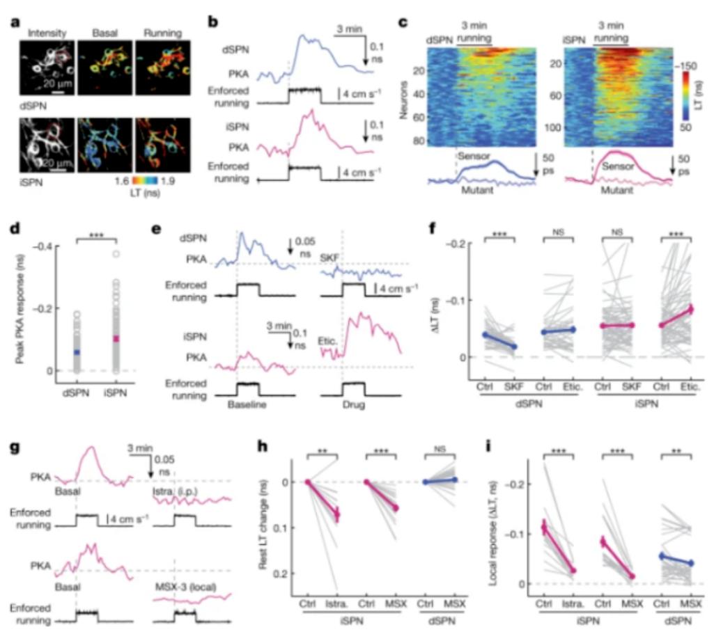 为治疗帕金森病带来新方法，北大发现大脑控制运动的“刹车”机制