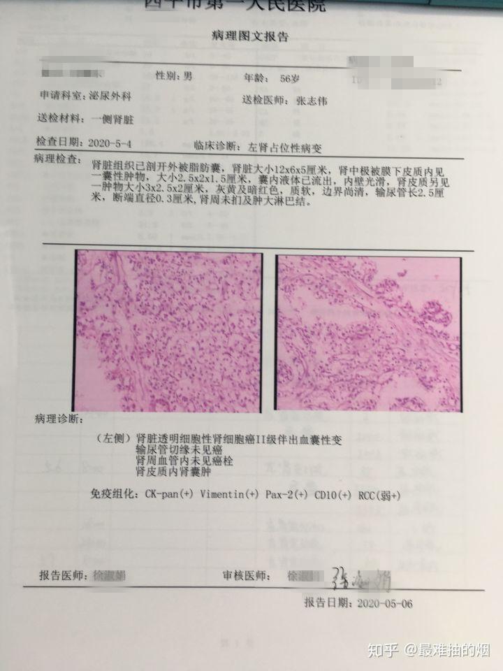 患肾癌后的心路历程,切还是不切