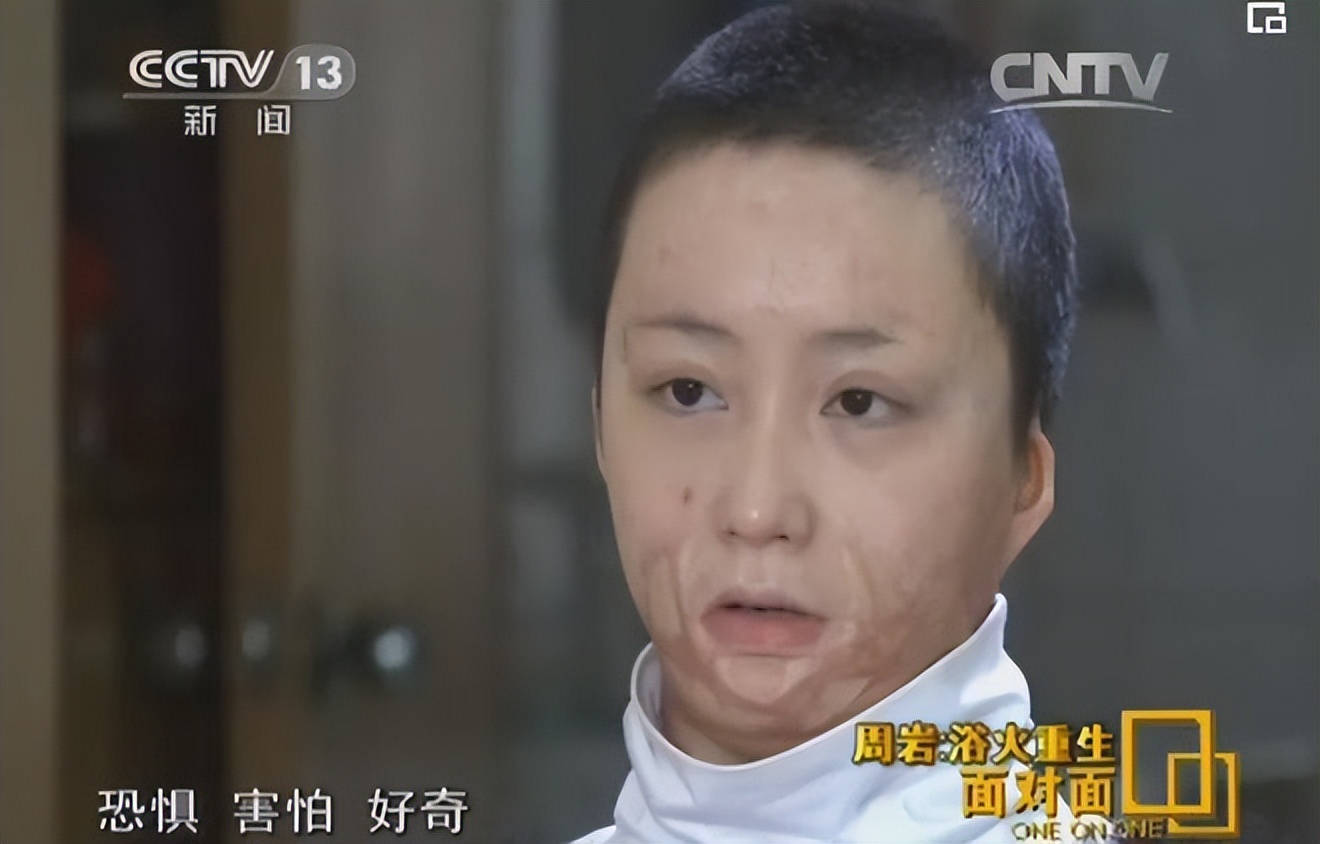 16岁女孩拒绝官二代求爱被毁容,拒绝富二代追求遭毁容以前照片