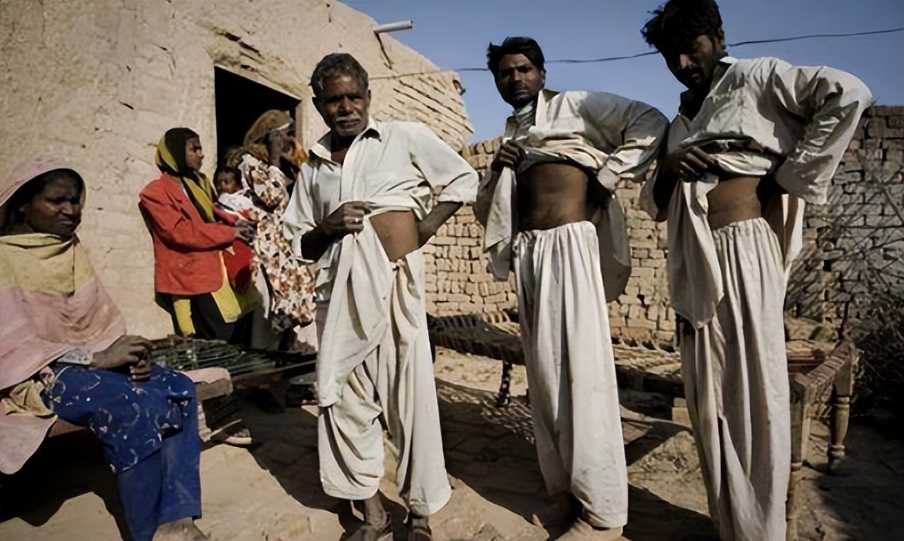 尼泊尔“卖肾村”：穷人们以700美元高价出售，人人身上一道疤