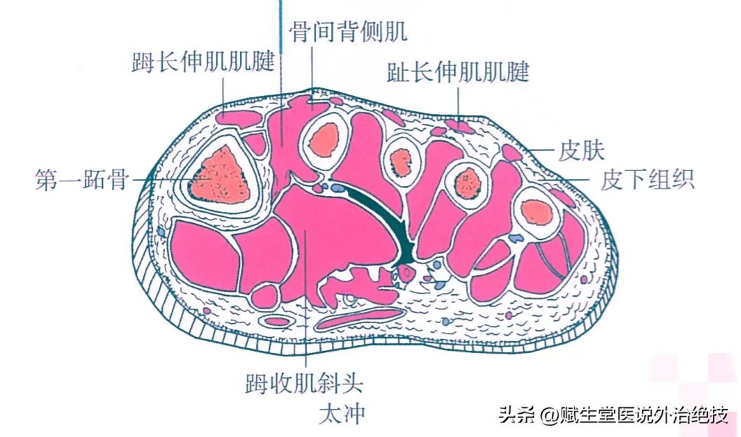 肝火上炎，五穴一方来解决
