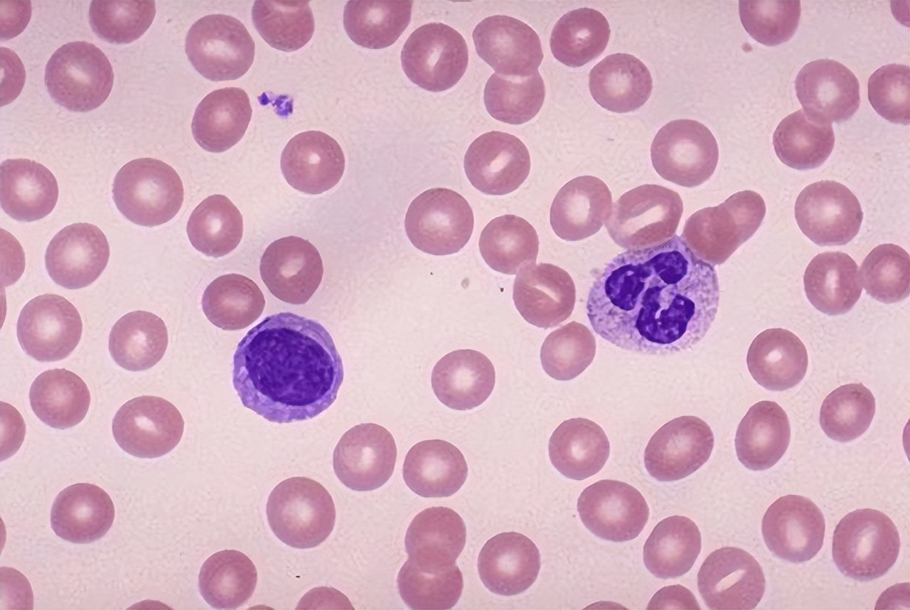 血常规中哪些指标升高需要再查,血常规各项指标偏高如何快速降低