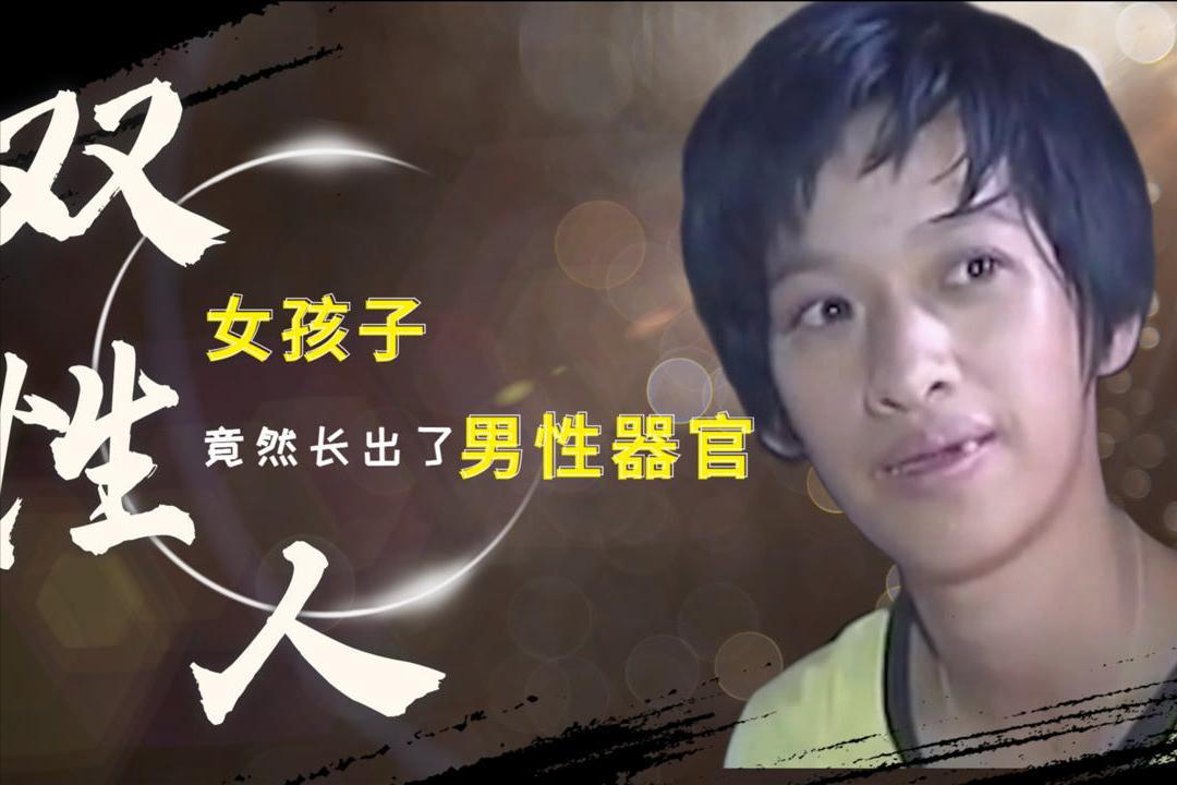 阴阳人的存在,阴阳人是先天的吗