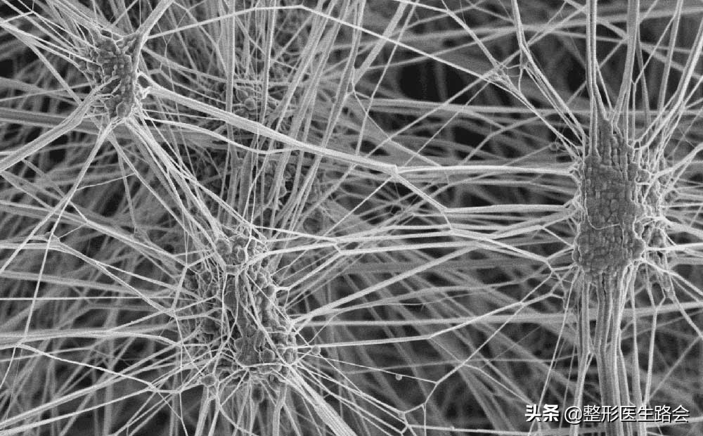 做膨体隆鼻感染了怎么办,膨体隆鼻注意事项