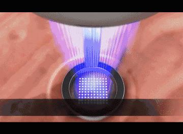 中医祛斑美白的最快方法,牙膏白醋祛斑美白方法