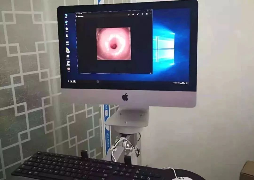 女性切除子宫后能干重活吗,女性切除子宫以后还能来月经吗