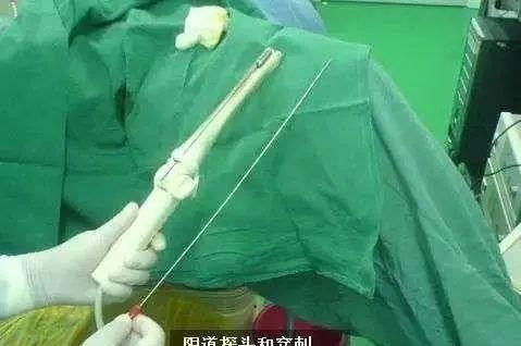 20岁女大学生“捐卵”差点死了，但很多人从中赚钱。