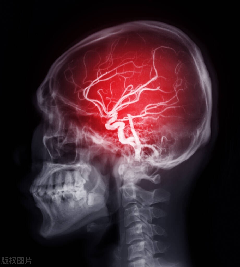 为什么高血压医生建议动手术,为什么医生说得了高血压是好事