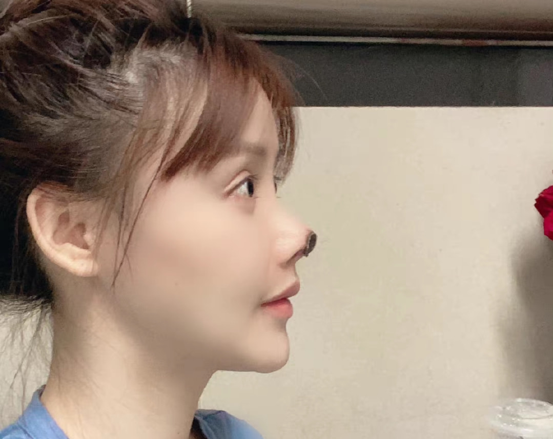 喝利尿剂，洗肠瘦小腹，整骨十次，女明星为了变美简直不要太狠