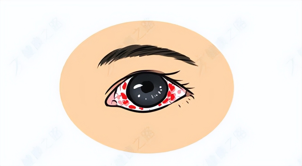 市面上的眼药水,眼药水最好怎么用才能不伤眼睛