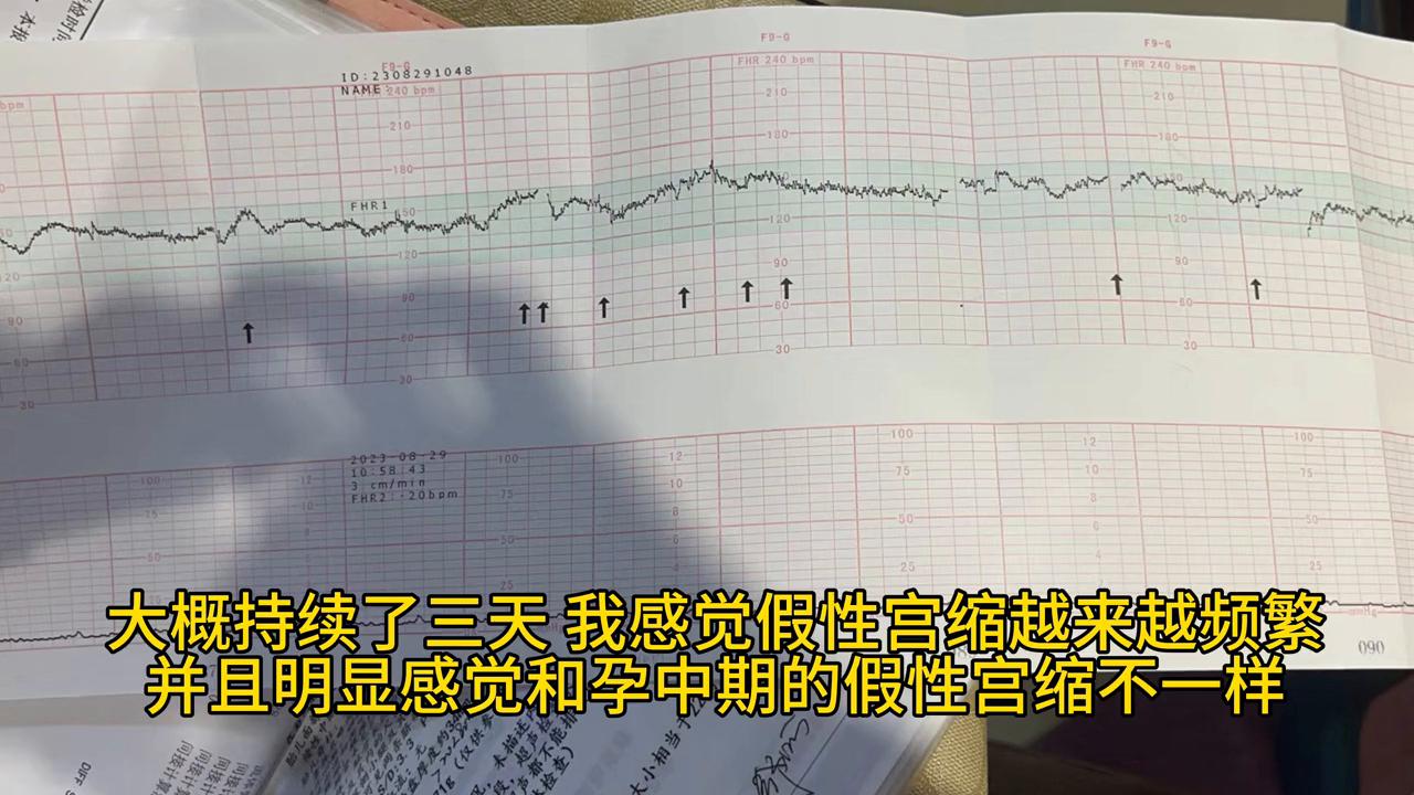 34周做胎监出现宫缩怎么回事,孕34周假性宫缩是什么感觉