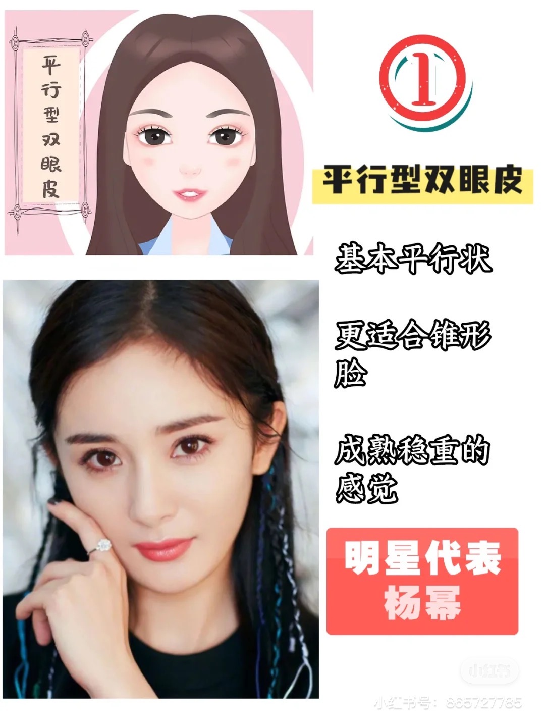 整形科普知识修复双眼皮,双眼皮整形有哪些常见方法