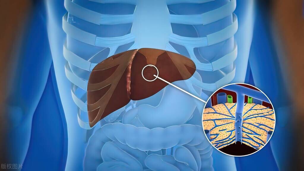 腹部水肿症状有哪些,腹部水肿的症状有哪些