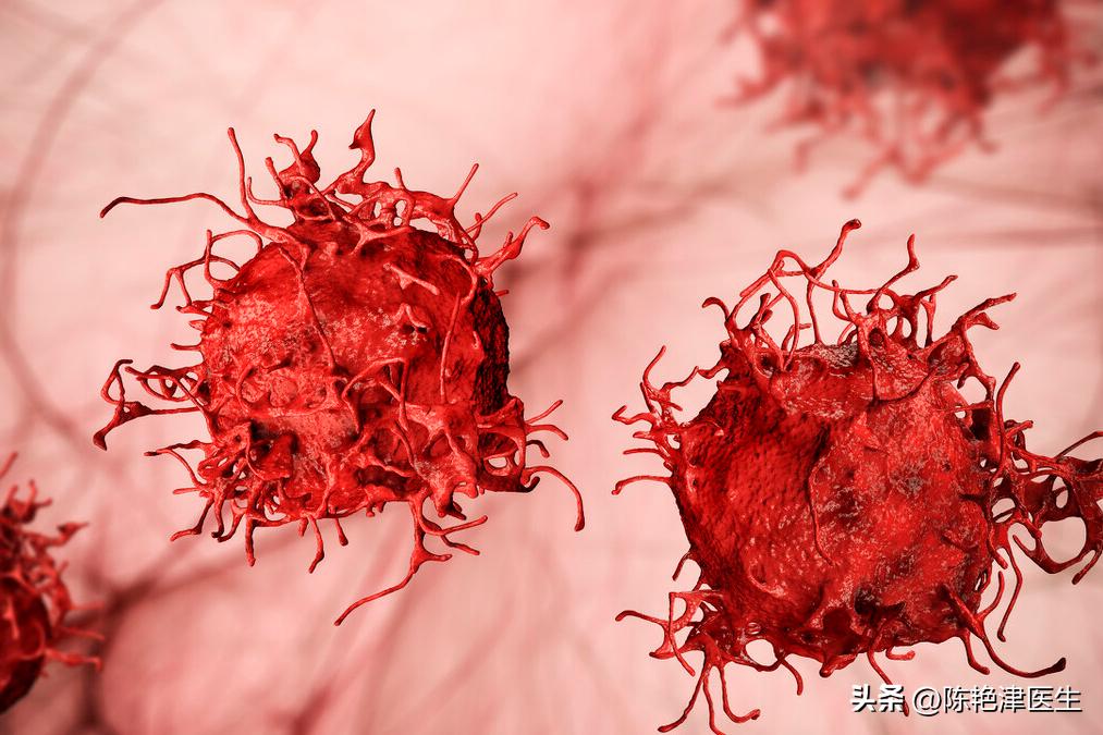 赵忠祥鳞状细胞癌早期症状,赵忠祥鳞状细胞癌有什么症状