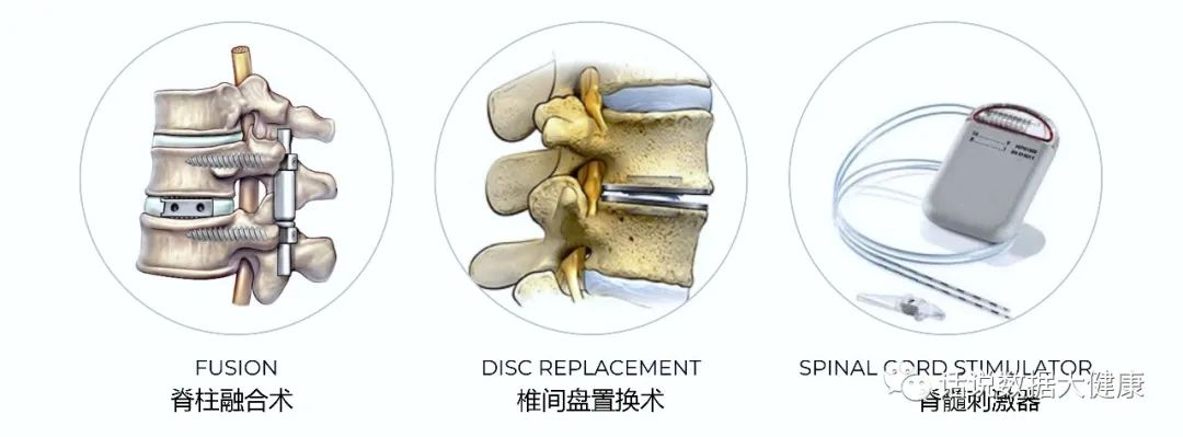 疼痛冷敷凝胶,疼痛冷敷凝胶的功效