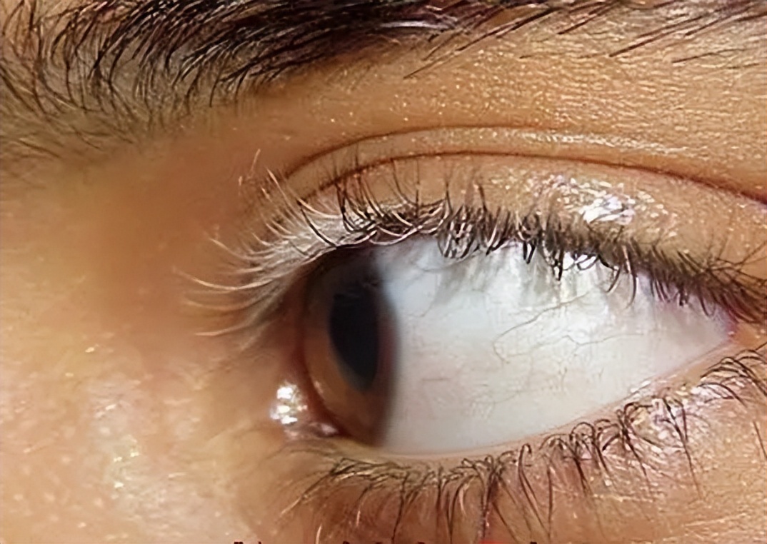 怎么知道白癜风治疗有效果,引起白癜风的主要因素有哪些呢