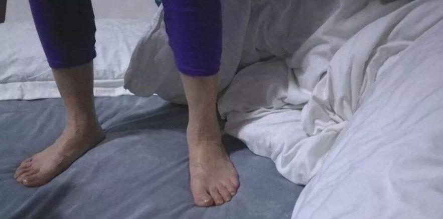 冬季皮肤皮屑满天飞,冬天来了皮肤干燥脱衣服有皮屑