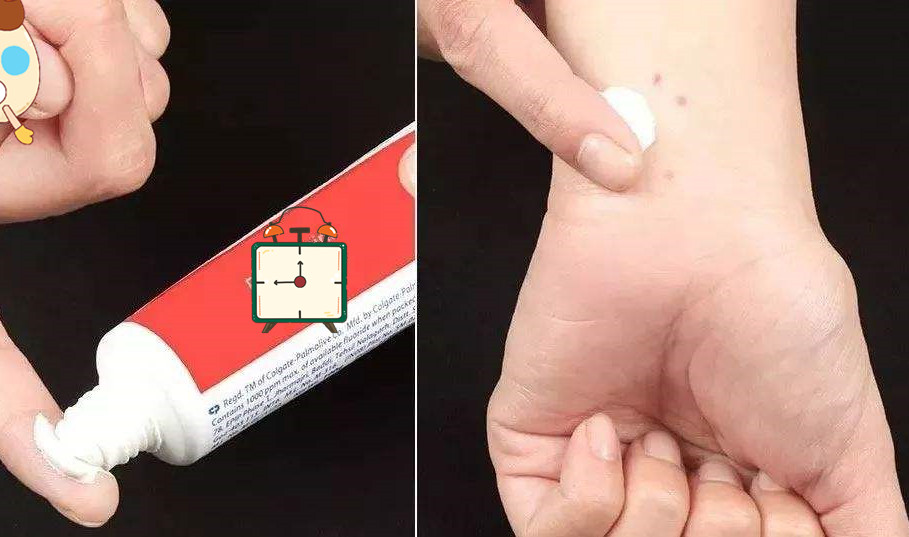 宝宝被蚊子咬了肿痒擦什么,宝宝被蚊子咬特别肿怎么办