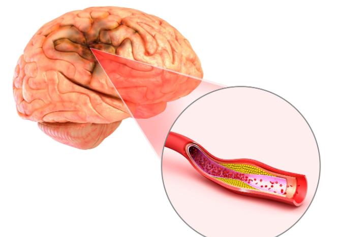 体检一般检查哪些项目中老年女性,中老年人体检要做哪几项检查