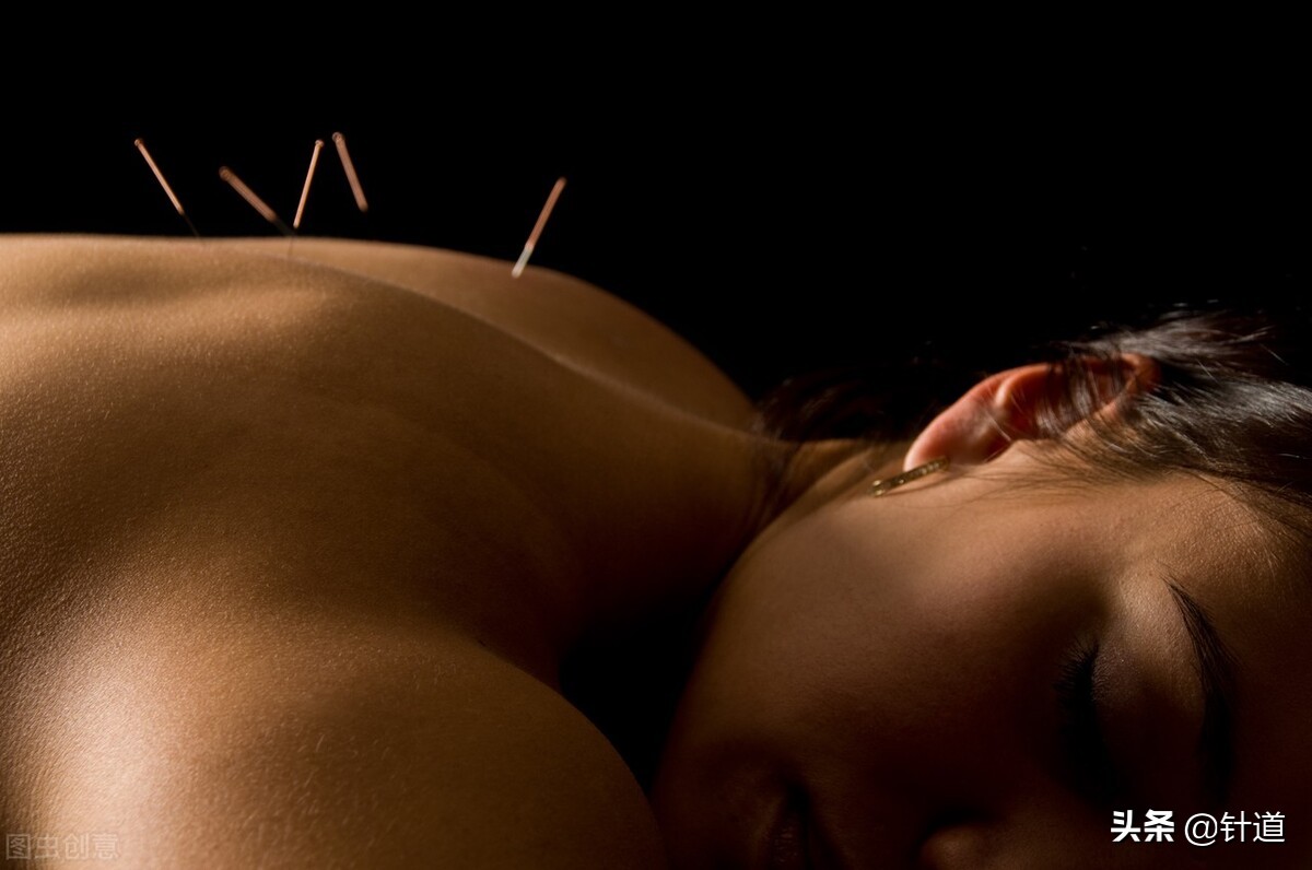 贺普仁的贺氏针灸三通法详解,针灸贺普仁